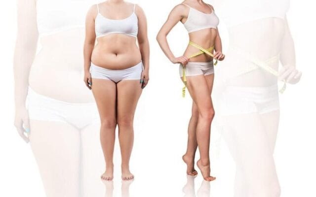 Có Nên Hút Mỡ Bụng Không